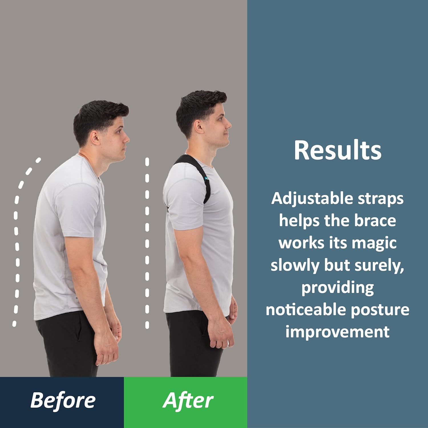 Posture Corrector Brace view 2